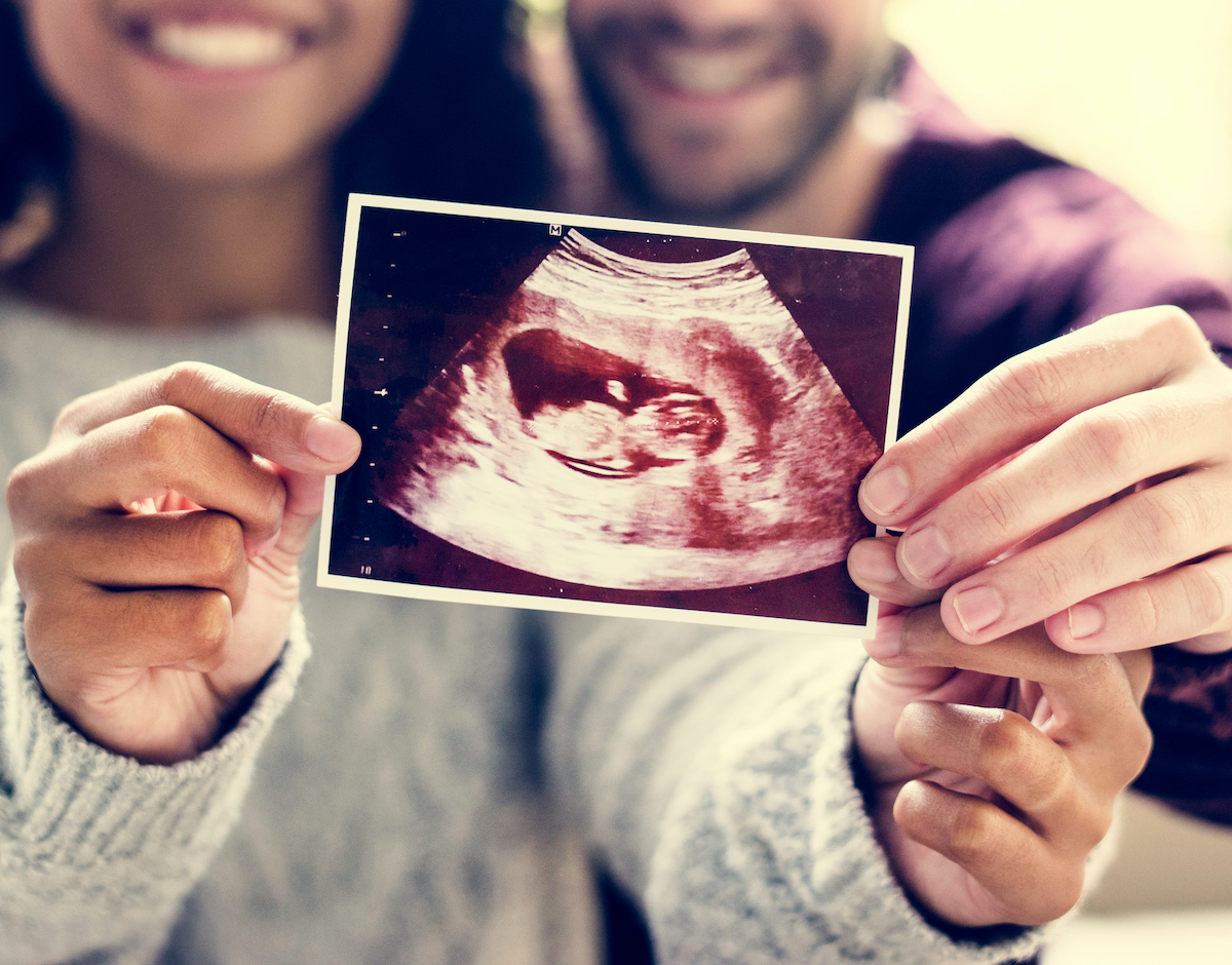 Couple showing their ultrasound photo after successfully getting pregnant through IVF at our North Houston fertility clinic