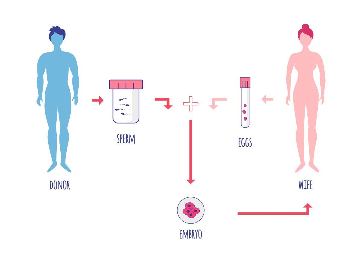 Diagram of North Houston IVF process