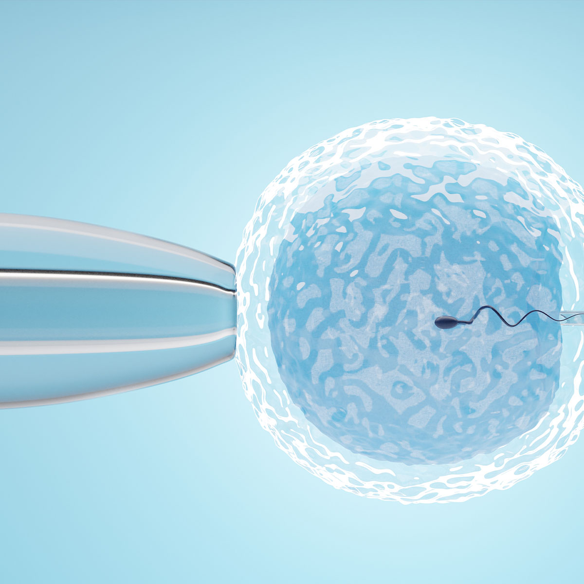 A sperm cell implanted into an egg