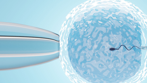 A sperm cell implanted into an egg