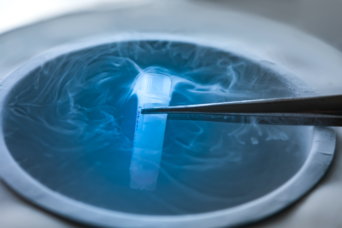 North Houston IVF With Frozen Eggs