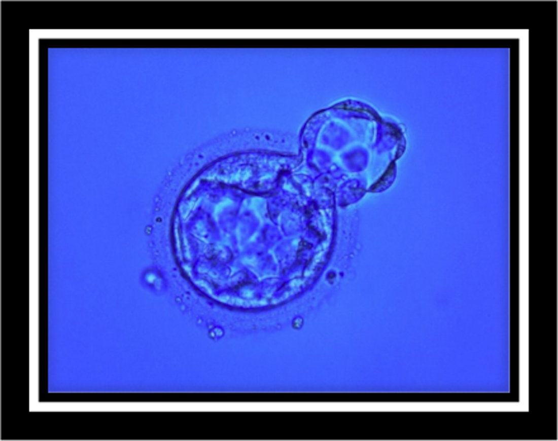 embryo