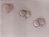 2-cell and 4-cell embryos, 2 days after egg retrieval.