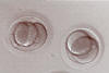3-cell and 2-cell embryos, 2 days after egg retrieval.