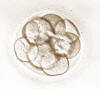 8-cell embryo, 3 days after egg retrieval.