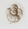 8-cell embryo, compacting, 4 days after egg retrieval.