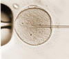 ICSI injection of sperm is completed as part of the fertilization process.