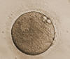 Two pronuclei seen at 10 o’clock, day 1 after oocyte retrieval.