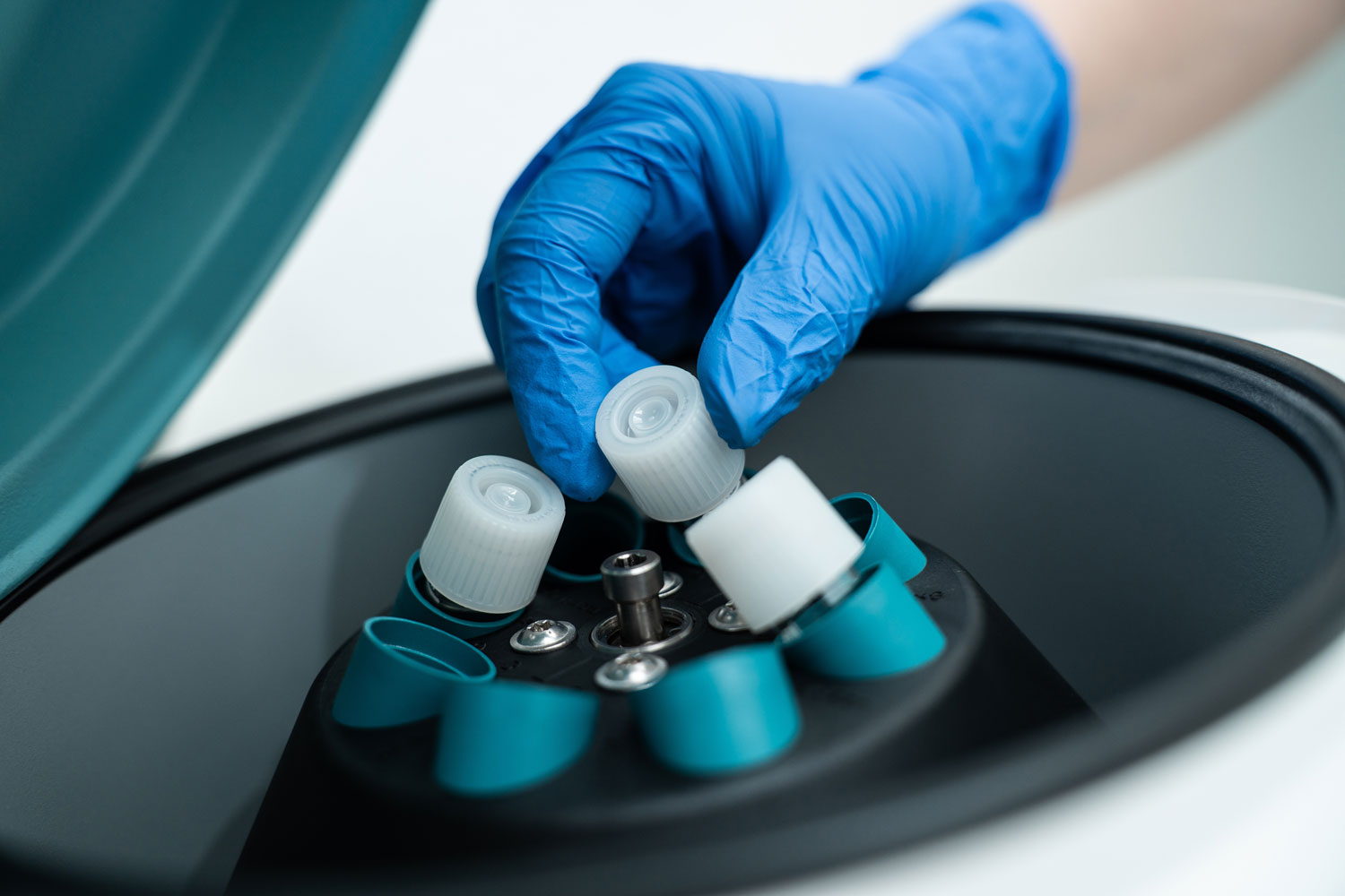 Egg Cells Being Preserved