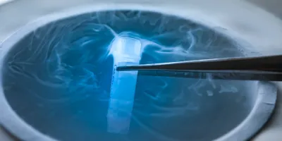 Vile of frozen eggs to be used during a North Houston IVF treatment
