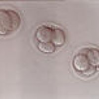 2-cell and 4-cell embryos, 2 days after egg retrieval.