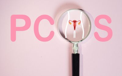 A graphic on PCOS