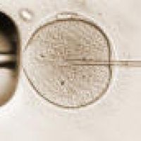 ICSI injection of sperm is completed as part of the fertilization process.