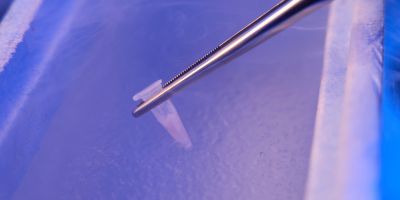 A microscopic view of Kingwood IVF