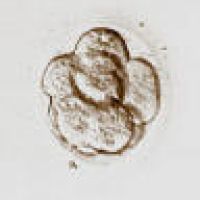 8-cell embryo, compacting, 4 days after egg retrieval.