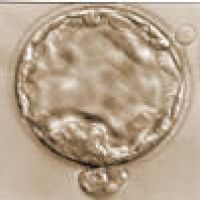 Expanded blastocyst, beginning to hatch.