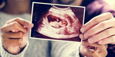 Couple showing their ultrasound photo after successfully getting pregnant through IVF at our North Houston fertility clinic