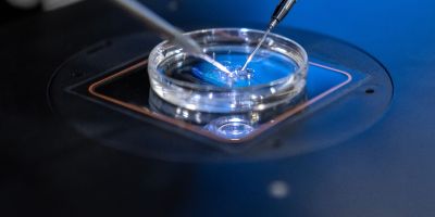 ICSI happening in the lab