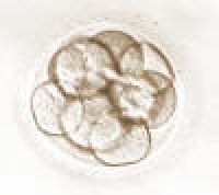 8-cell embryo, 3 days after egg retrieval.