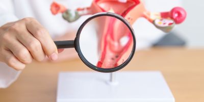 A model of a uterus