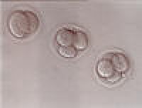 2-cell and 4-cell embryos, 2 days after egg retrieval.