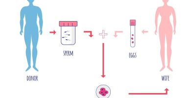Diagram of North Houston IVF process