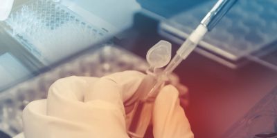 researcher loading genetic sample